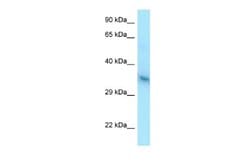 YIPF1 Rabbit anti-Human, Polyclonal, Novus Biologicals 0.1ml; Unconjugated:Antibodies,